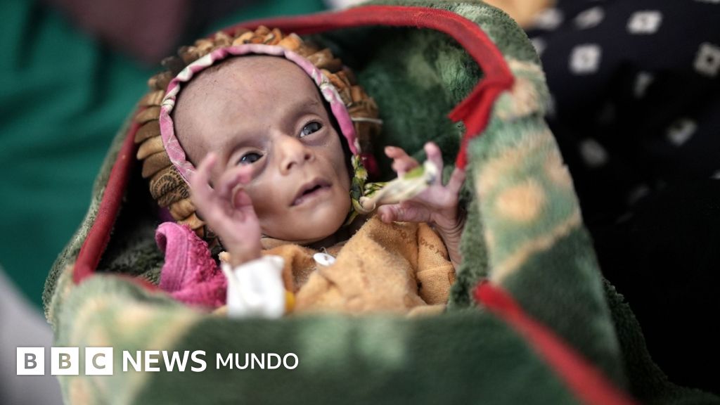 La tragedia silenciosa de Yemen: la agónica batalla de dos recién nacidos contra el hambre y la guerra