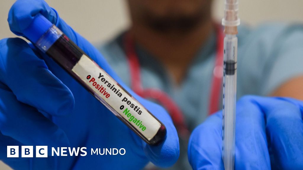 Alerta sanitaria internacional: qué es la peste neumónica y por qué el caso en un laboratorio de Siberia genera inquietud